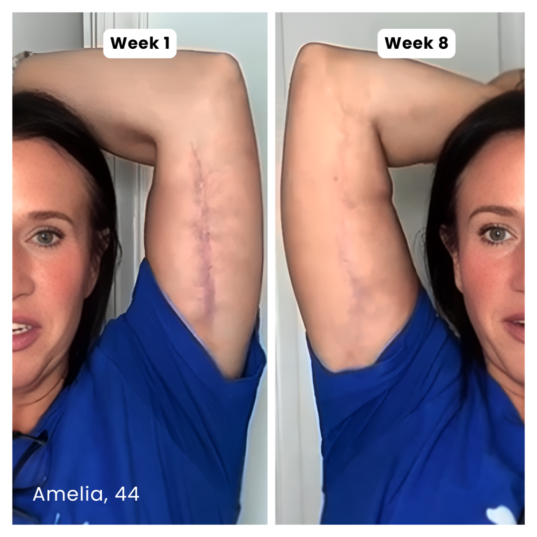 Prequel Anti-Aging Silicone Scar Stick