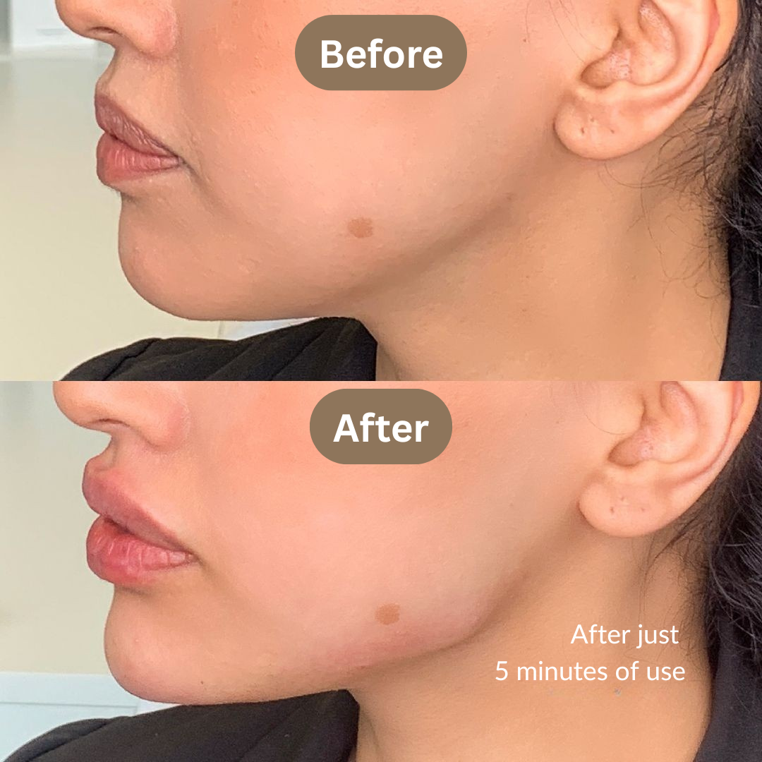 Solara™ Lymphatic Contour Face Brush