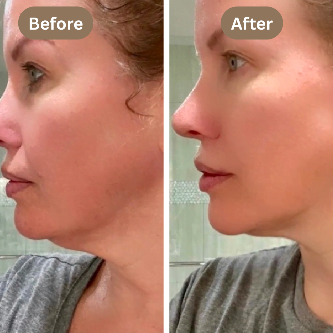 Solara™ Lymphatic Contour Face Brush