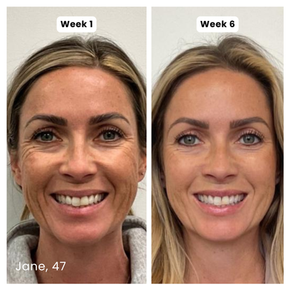 Prequel Anti-Aging Silicone Scar Stick